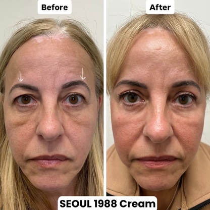Seoul 1988 Eye Contour Cream