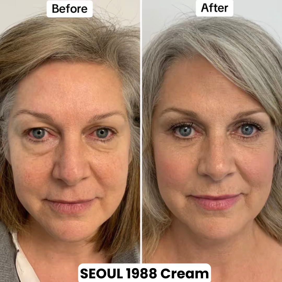Seoul 1988 Eye Contour Cream
