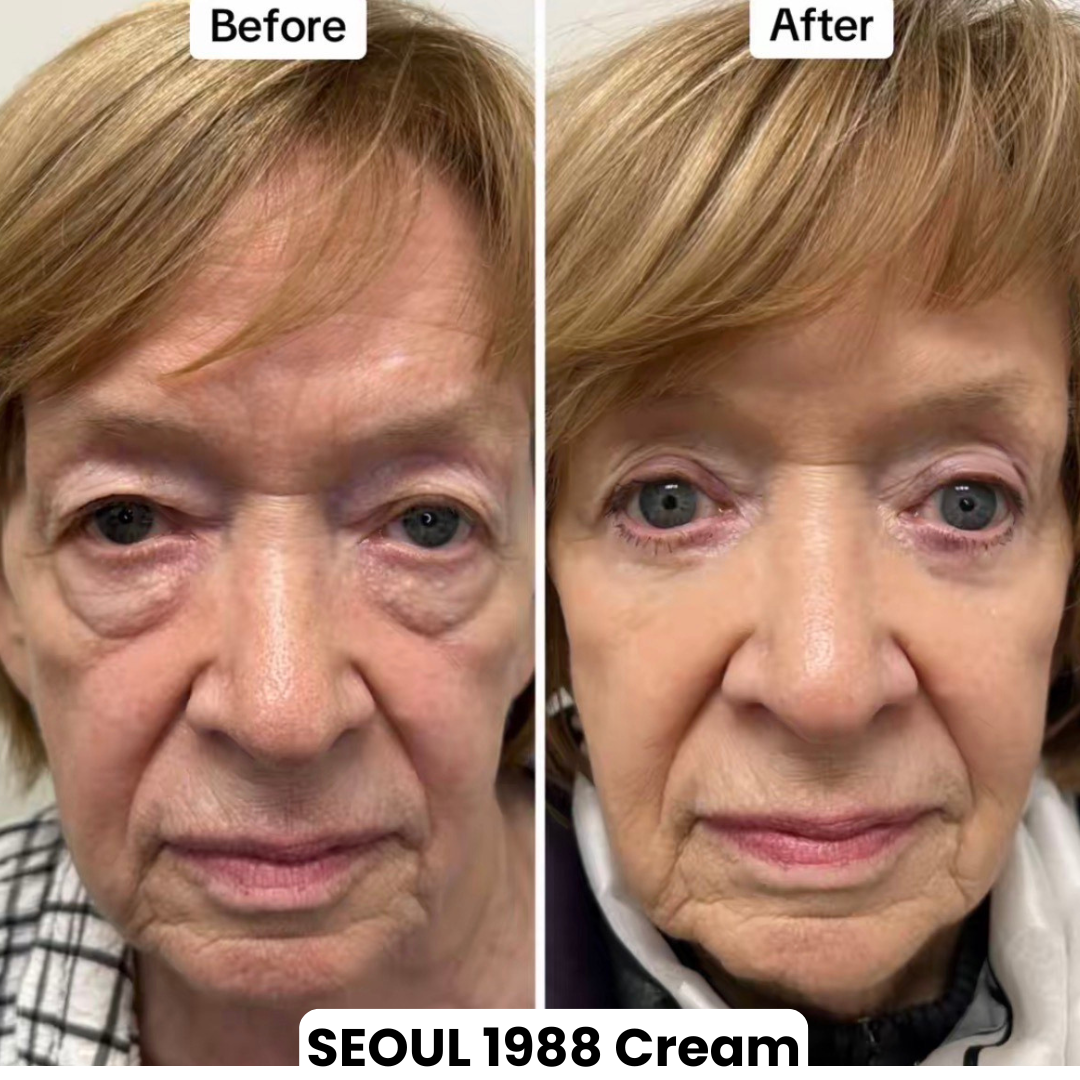 Seoul 1988 Eye Contour Cream