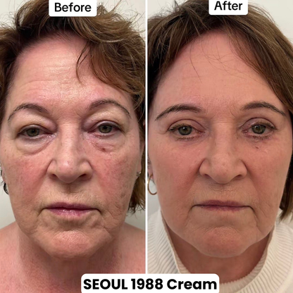 Seoul 1988 Eye Contour Cream